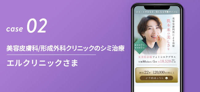 美容皮膚科・形成外科クリニックのシミ治療|エルクリニックさま